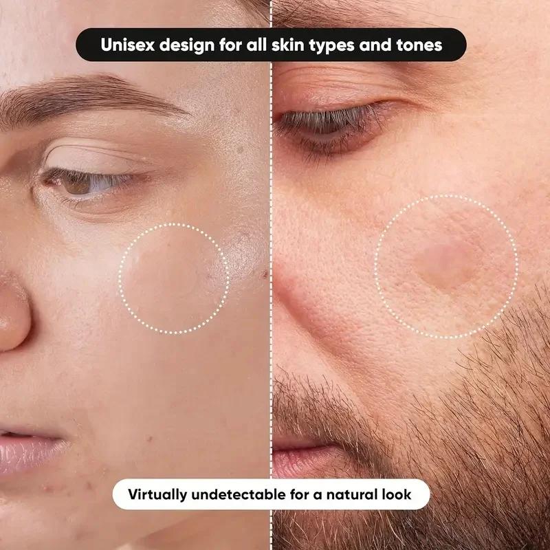 360枚/箱 ニキビパッチ - アルコールフリー、ニキビの分 - Face Oil のレビューと価格