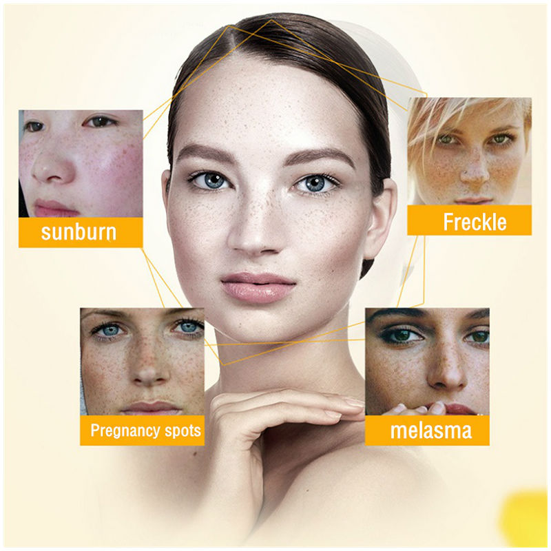 Dimollaure 美白そばかすクリーム保湿引き締め抗しわ - Retinol Cream のレビューと価格