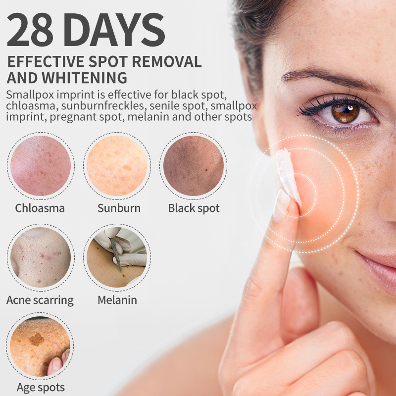 Dimollaure 美白そばかすクリーム保湿引き締め抗しわ - Retinol Cream のレビューと価格